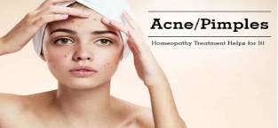 Persistent Pimples That Just Won’t Go? – Try Homeopathy in Aurangabad & Pune