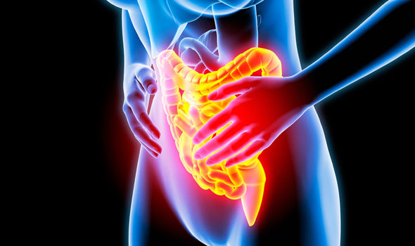 Crohn-s-disease-and-ulcerative-colitis-Symptoms-of-inflammatory-bowel-disease-explained-1019656